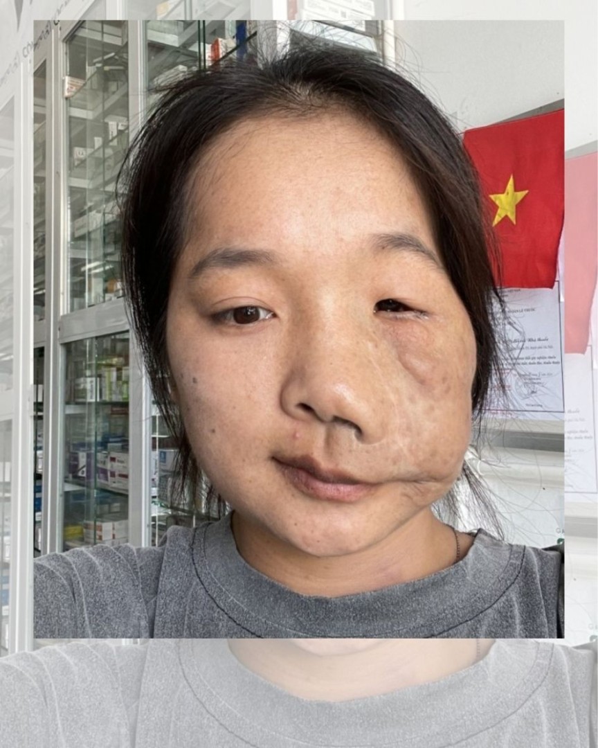 Ảnh lớn