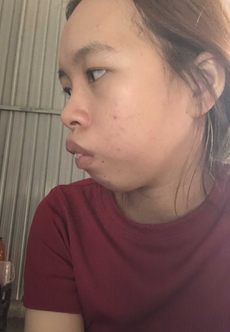 Nghiêng trái