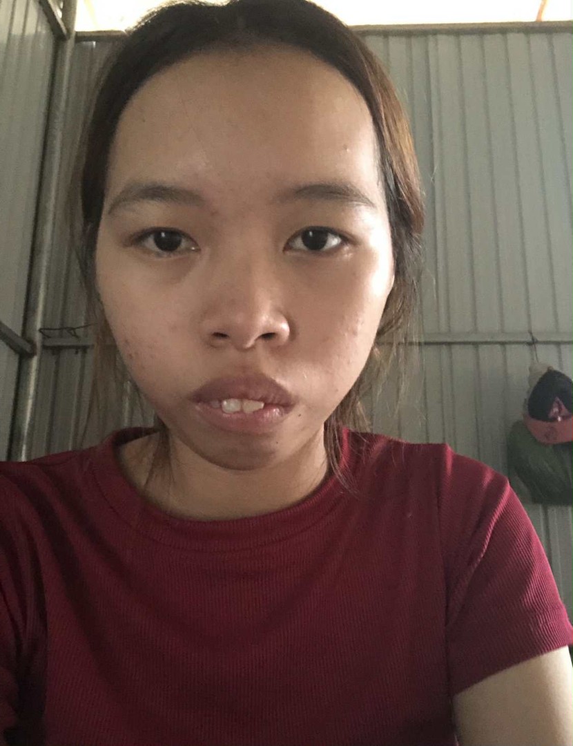 Ảnh lớn