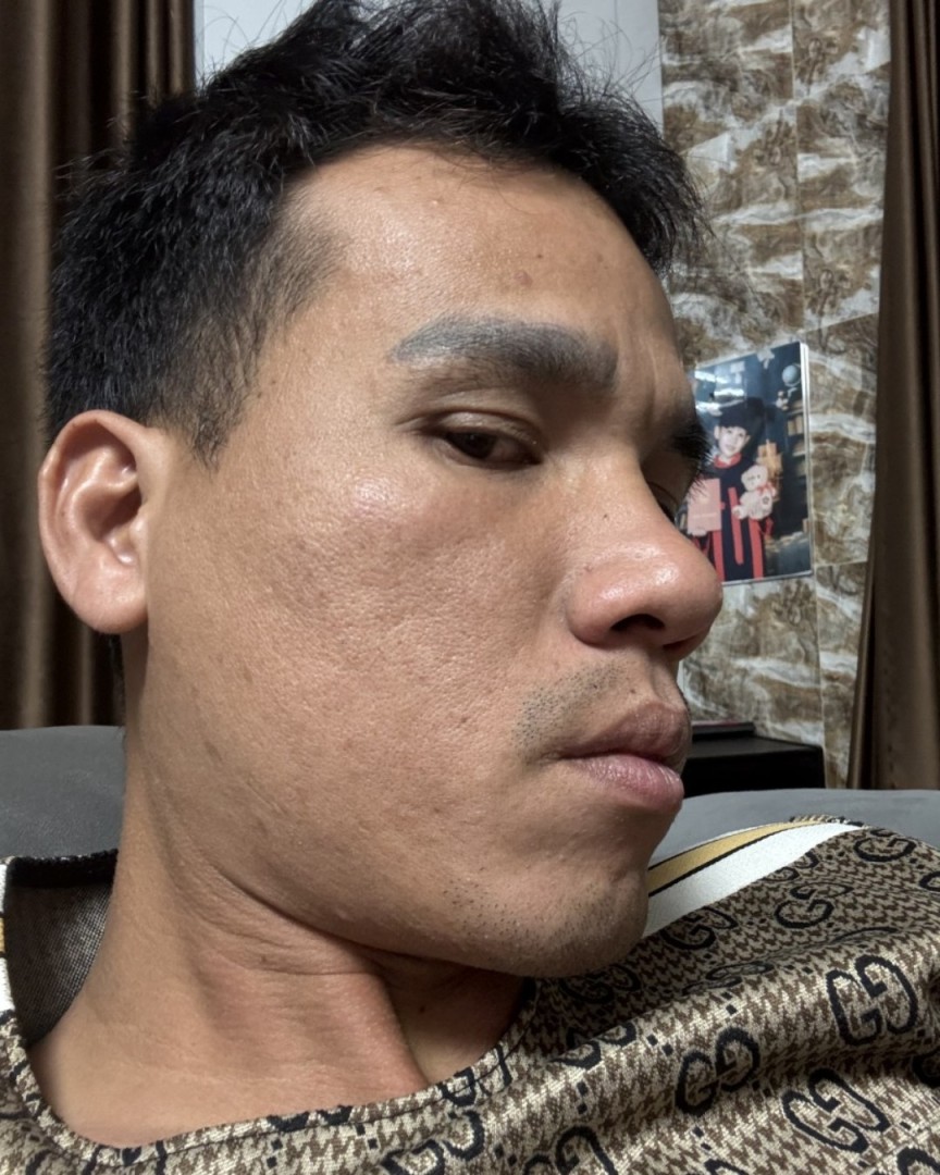 Nghiêng trái