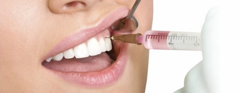 Tiêm botox trị cười hở lợi