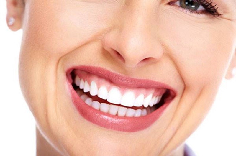 Chi phí trị cười hở lợi không phẫu thuật khá đa dạng
