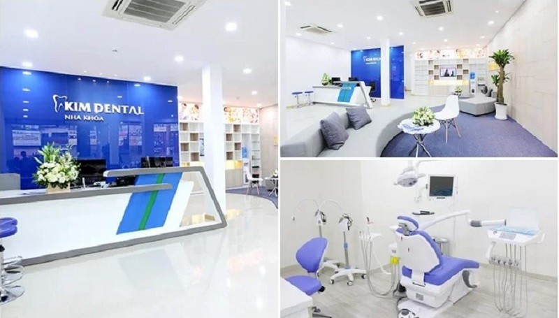 Nha khoa Kim thực hiện trị cười hở lợi