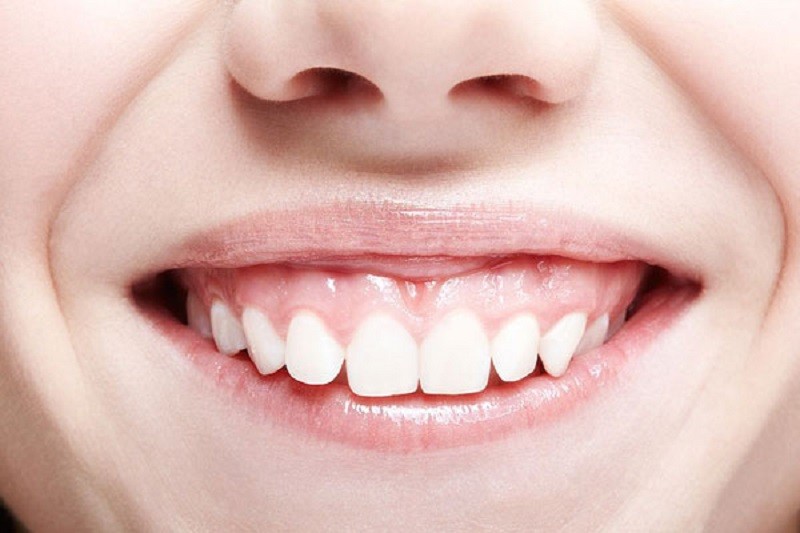 Những người bị cười hở lợi hoàn toàn có thể điều trị được