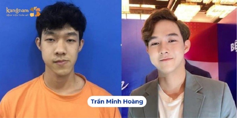 Dancer Minh Hoàng thành công hơn sau khi tham gia Hành trình Lột Xác