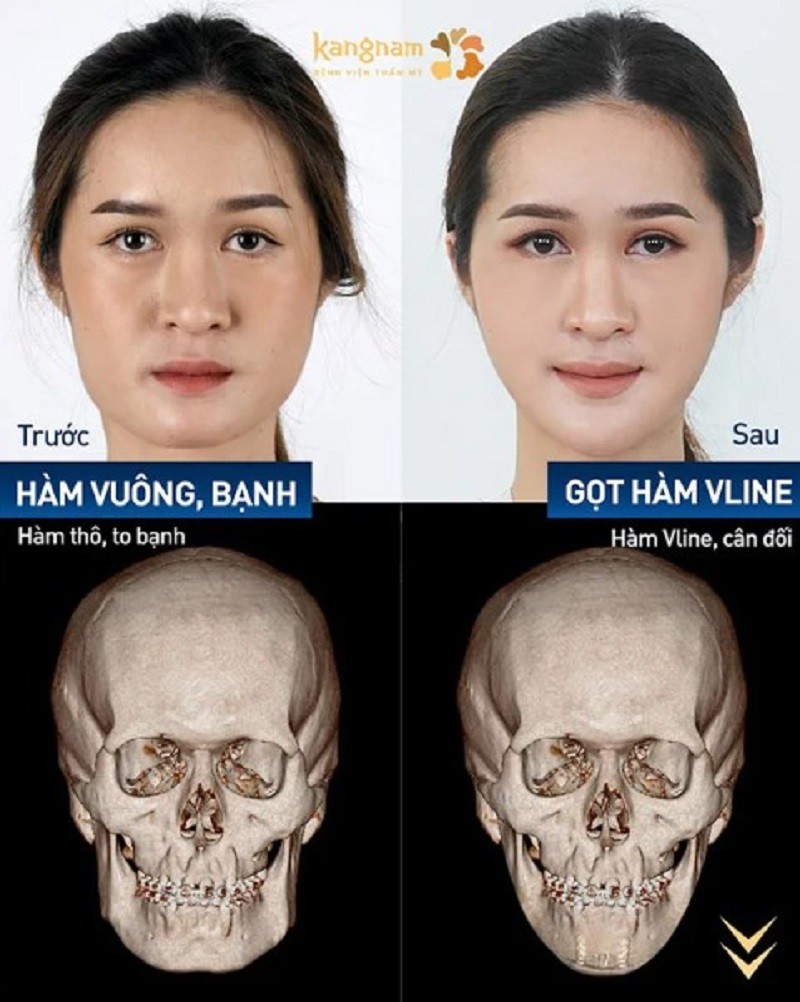 Bác sĩ sẽ thiết kế mô phỏng 3D trước khi phẫu thuật