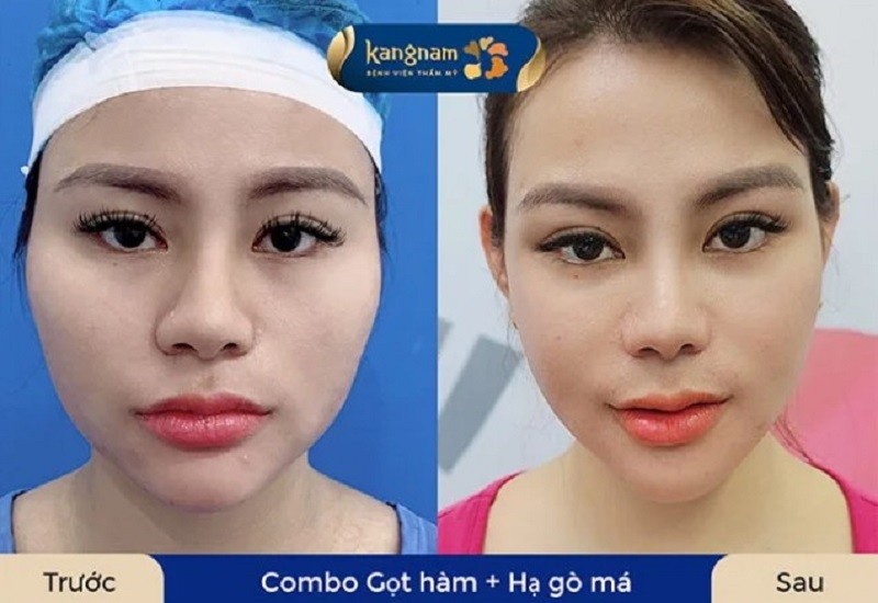 Tuân thủ đúng hướng dẫn của bác sĩ giúp khách hàng nhanh hồi phục
