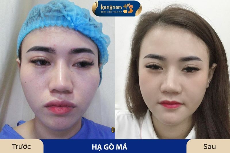 Chăm sóc tốt giúp rút ngắn thời gian hồi phục