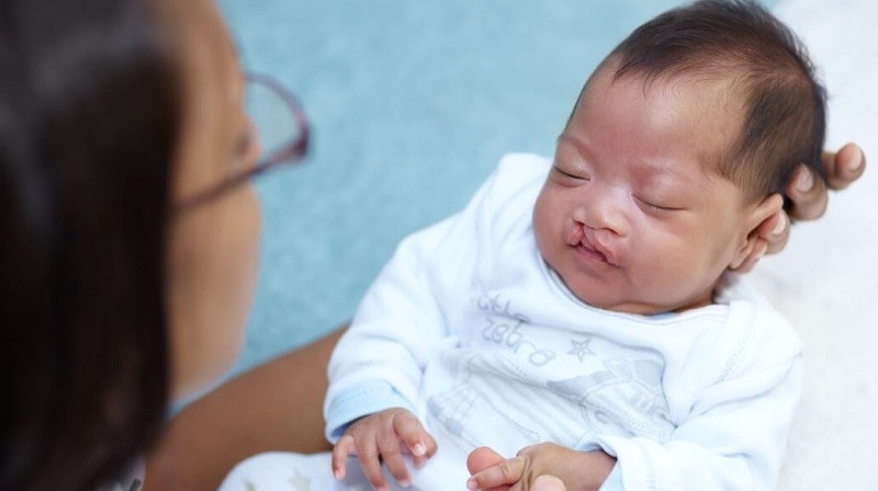 Mỗi giai đoạn sẽ có lịch trình phẫu thuật phù hợp 