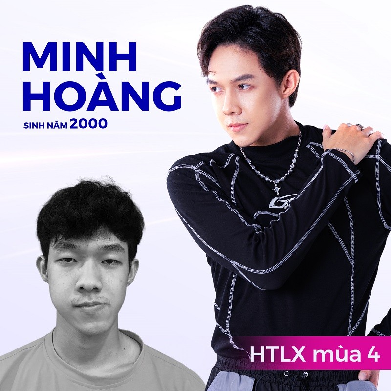 Chàng Dancer tài năng Trần Minh Hoàng, sở hữu diện mạo điển trai sau khi được thẩm mỹ