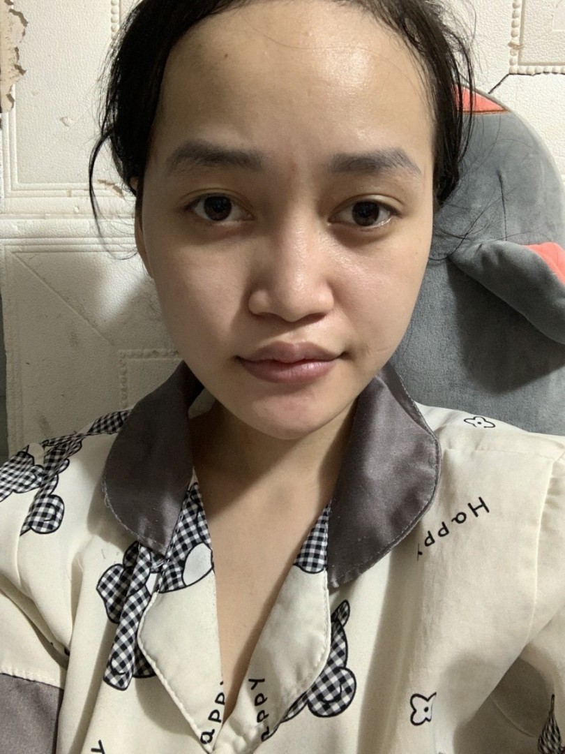 Ảnh lớn