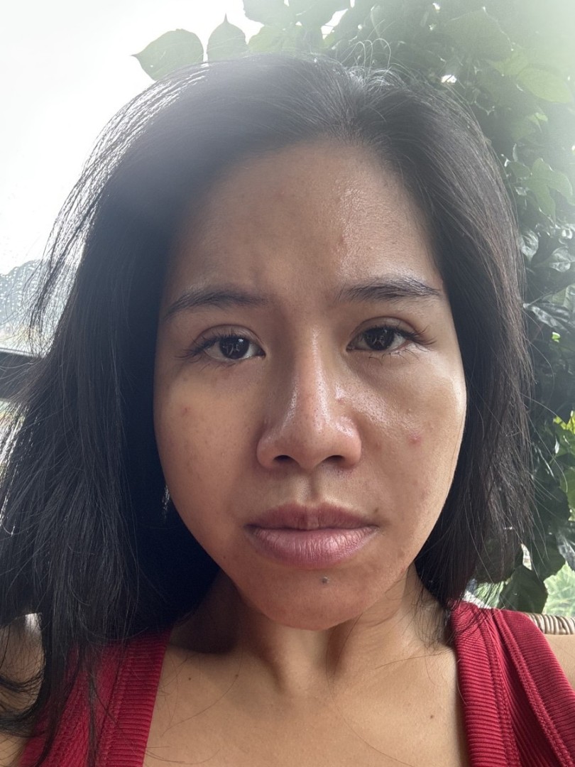 Ảnh lớn
