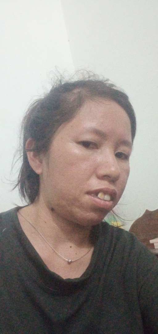 Nghiêng trái