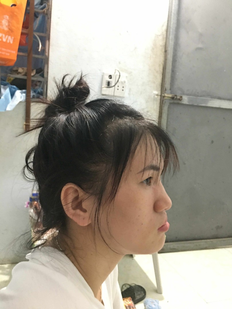 Nghiêng trái