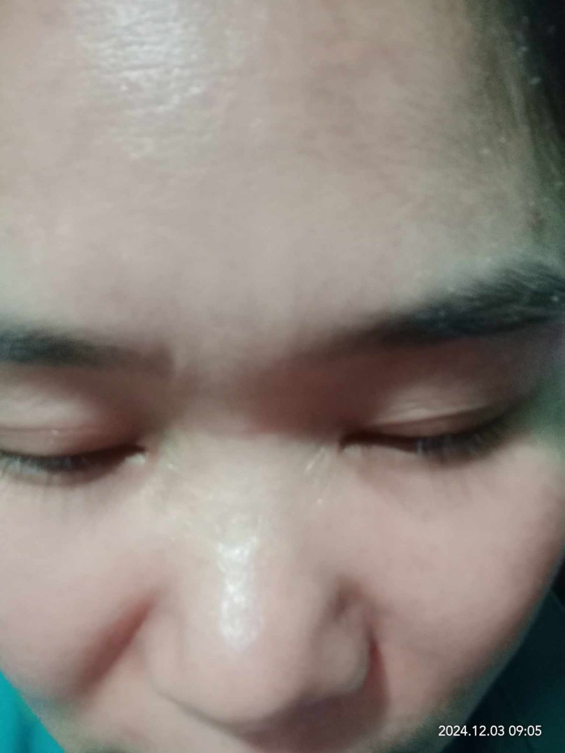 Ảnh lớn