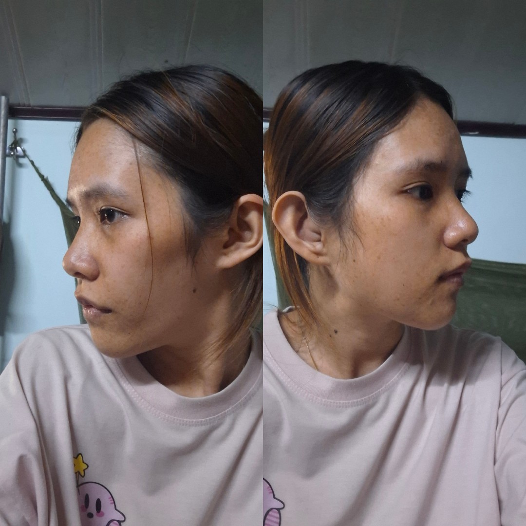 Nghiêng trái