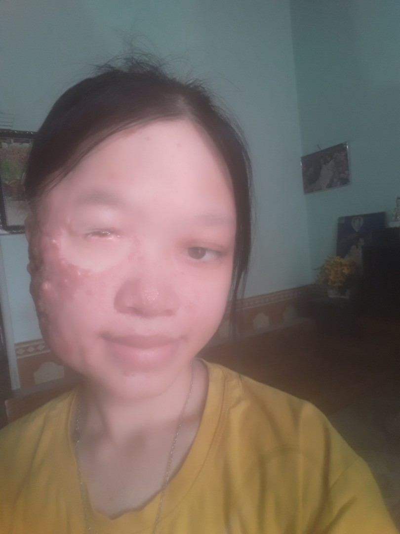 Ảnh lớn