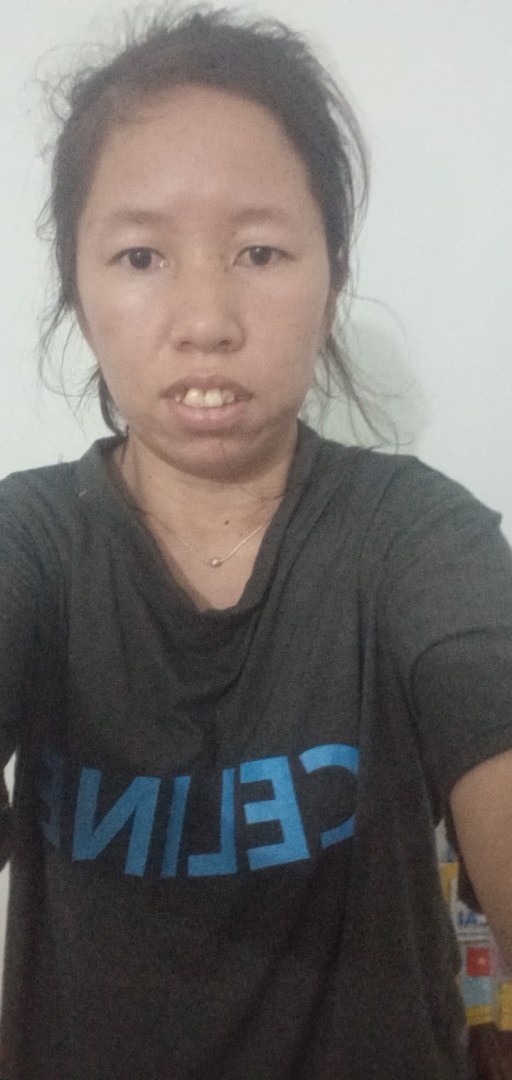 Toàn thân