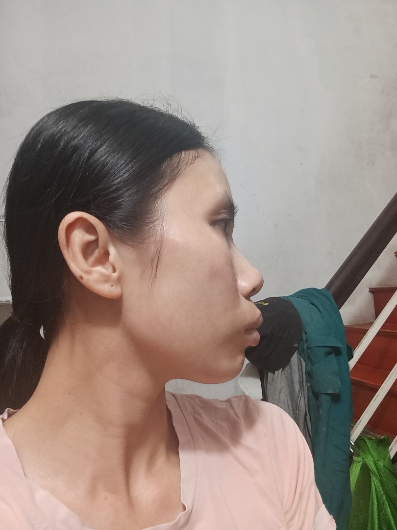 Nghiêng trái
