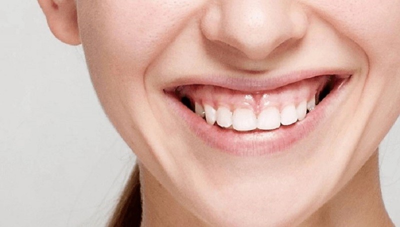 Theo nhân tướng học cười hở lợi không tốt cho công việc và cuộc sống