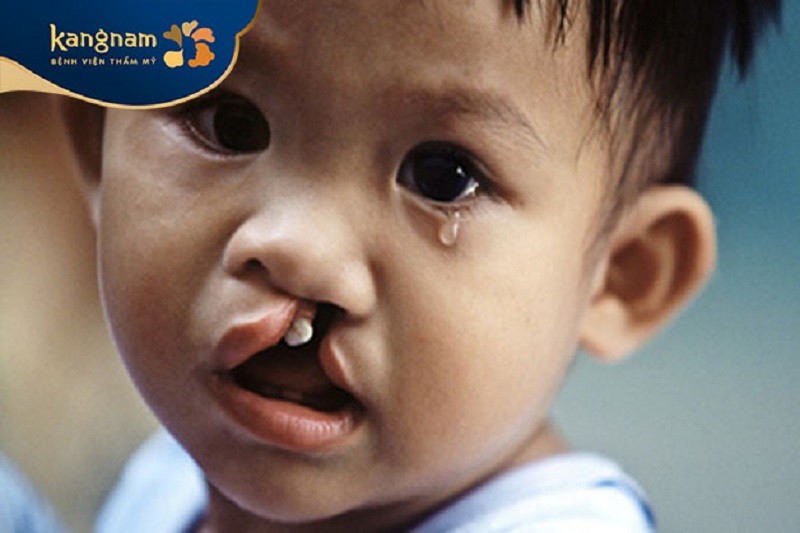 Trẻ phát âm hay khó nói chuyện