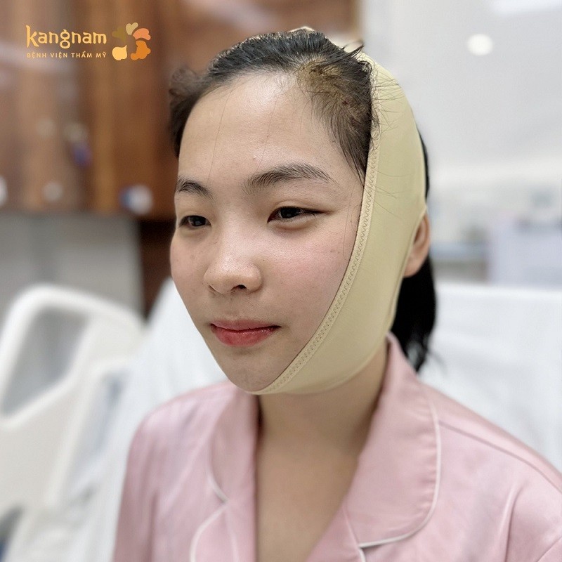 Tuân thủ theo hướng dẫn chăm sóc của bác sĩ và đeo đai định hình cằm