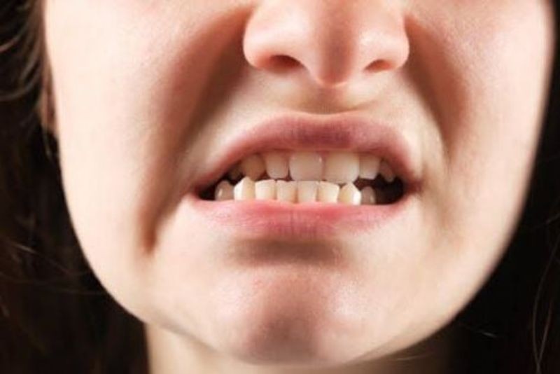 Lệch khớp cắn do trượt cằm sai kỹ thuật