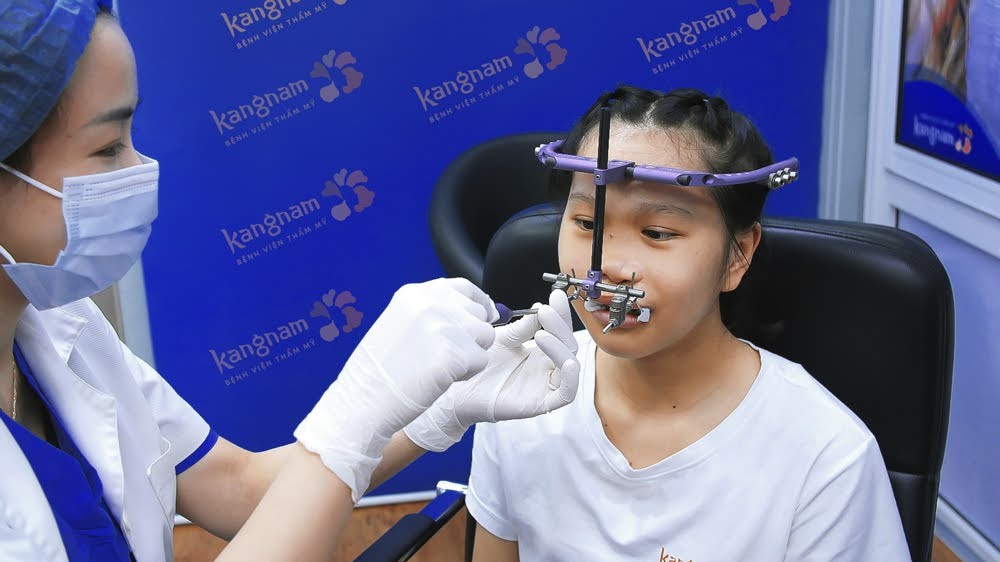 Khí cụ RED được sử dụng để cố định và kéo giãn xương hàm