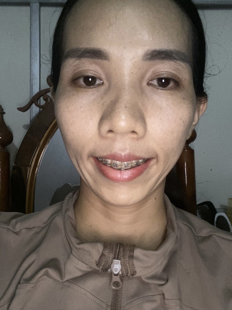 Ảnh lớn