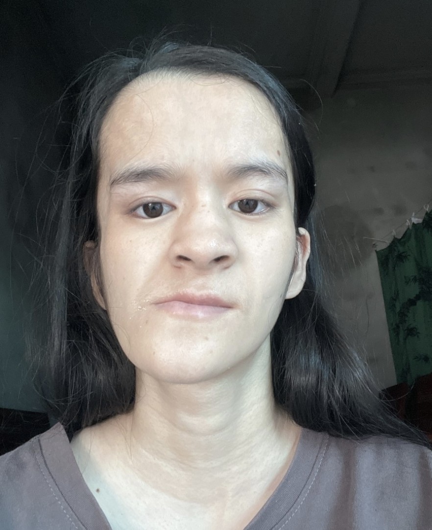 Ảnh lớn