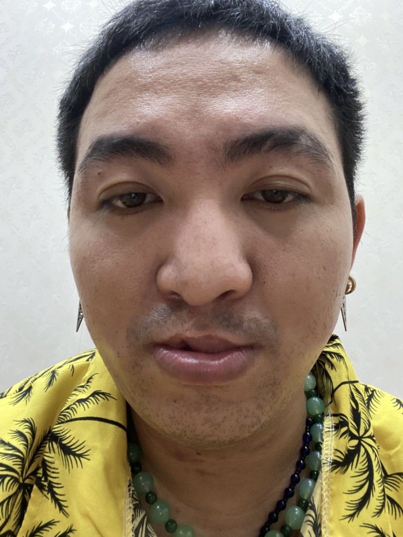 Ảnh lớn