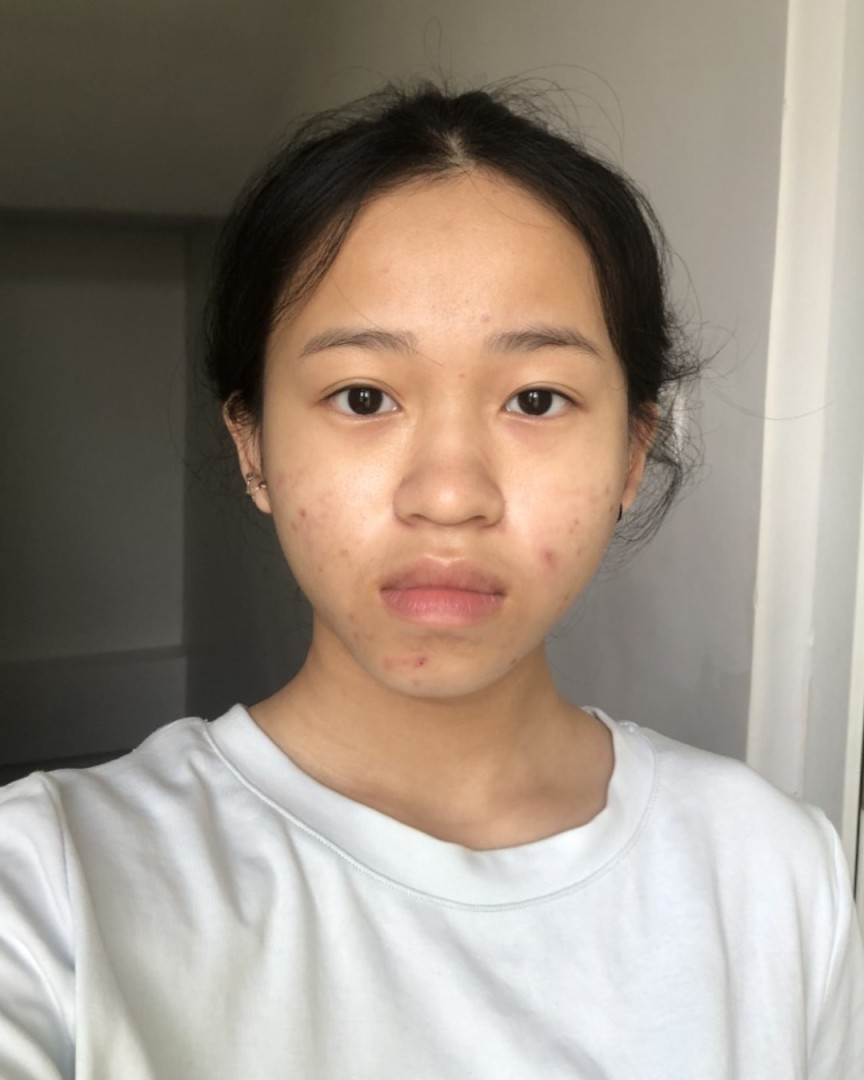 Ảnh lớn