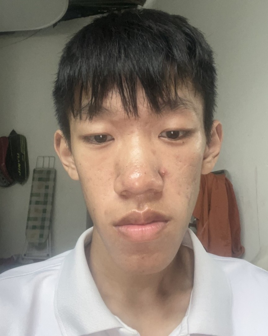 Ảnh lớn