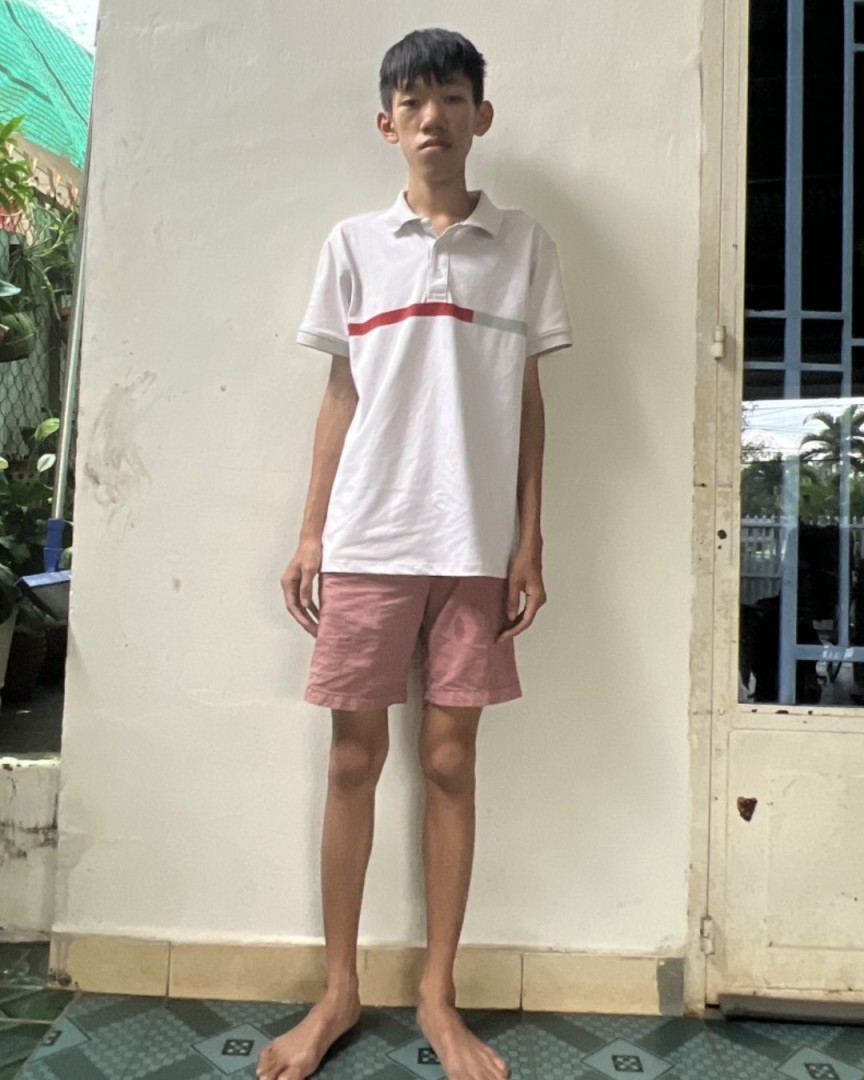 Toàn thân