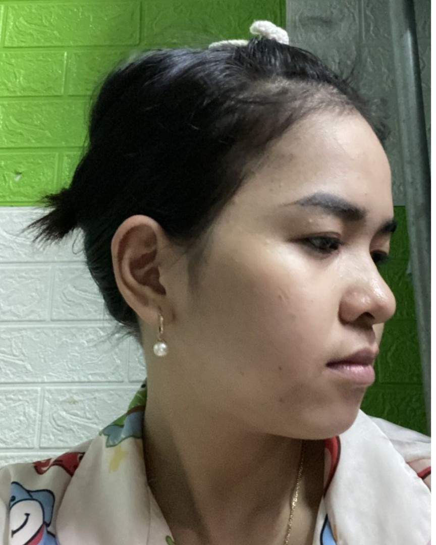 Ảnh lớn