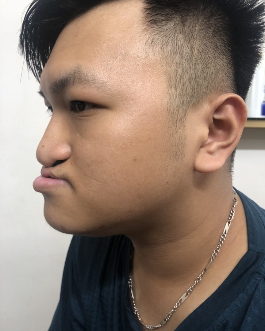 Nghiêng trái