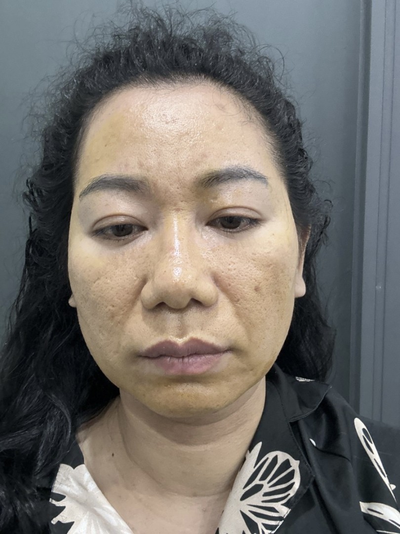 Ảnh lớn