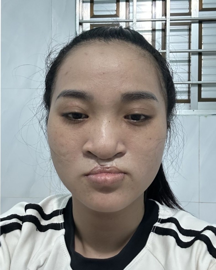 Ảnh lớn