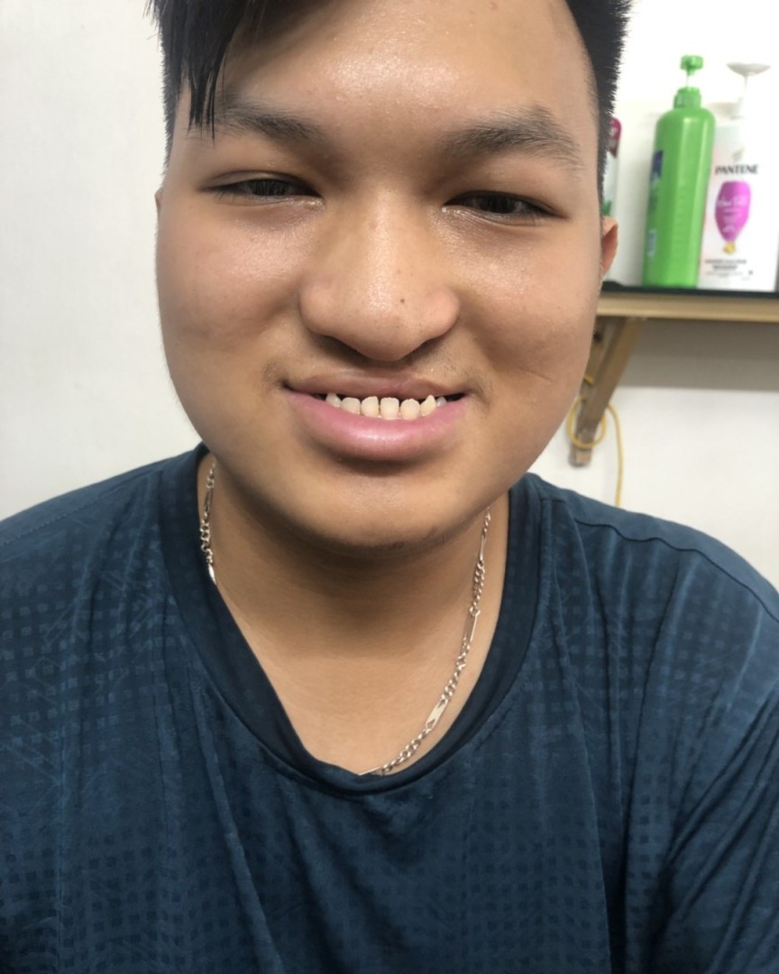 Ảnh lớn