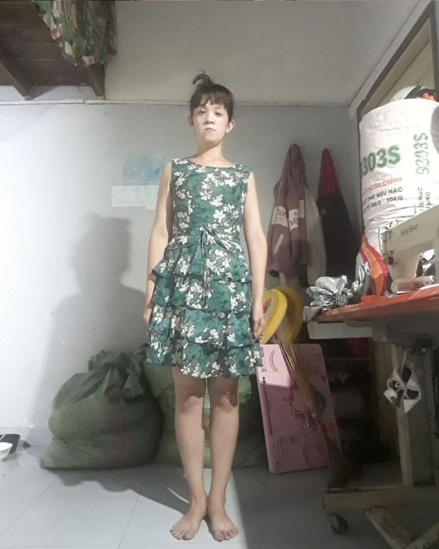 Toàn thân