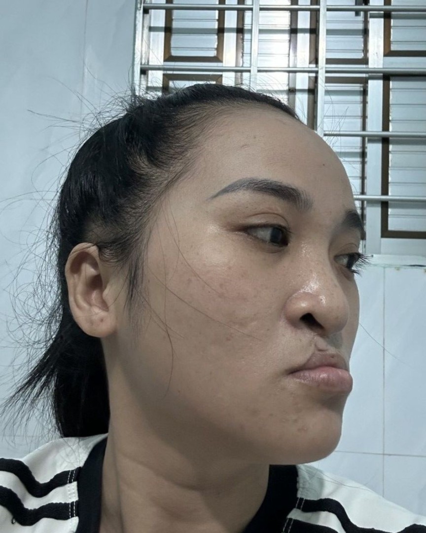Nghiêng trái