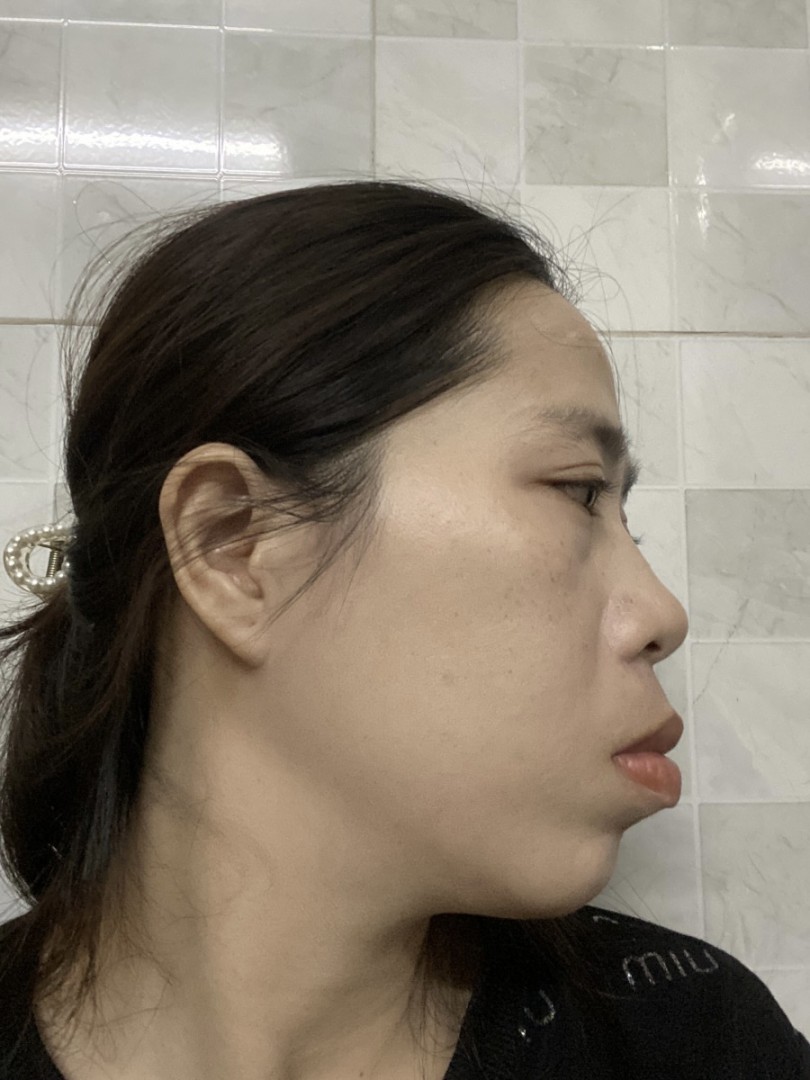Nghiêng trái