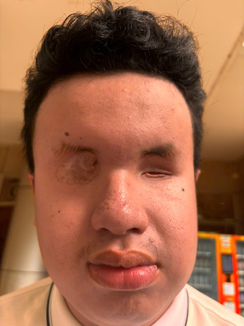 Ảnh lớn