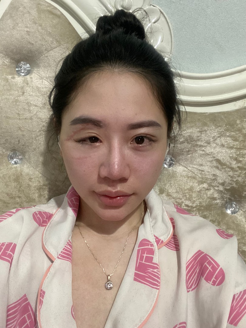 Ảnh lớn