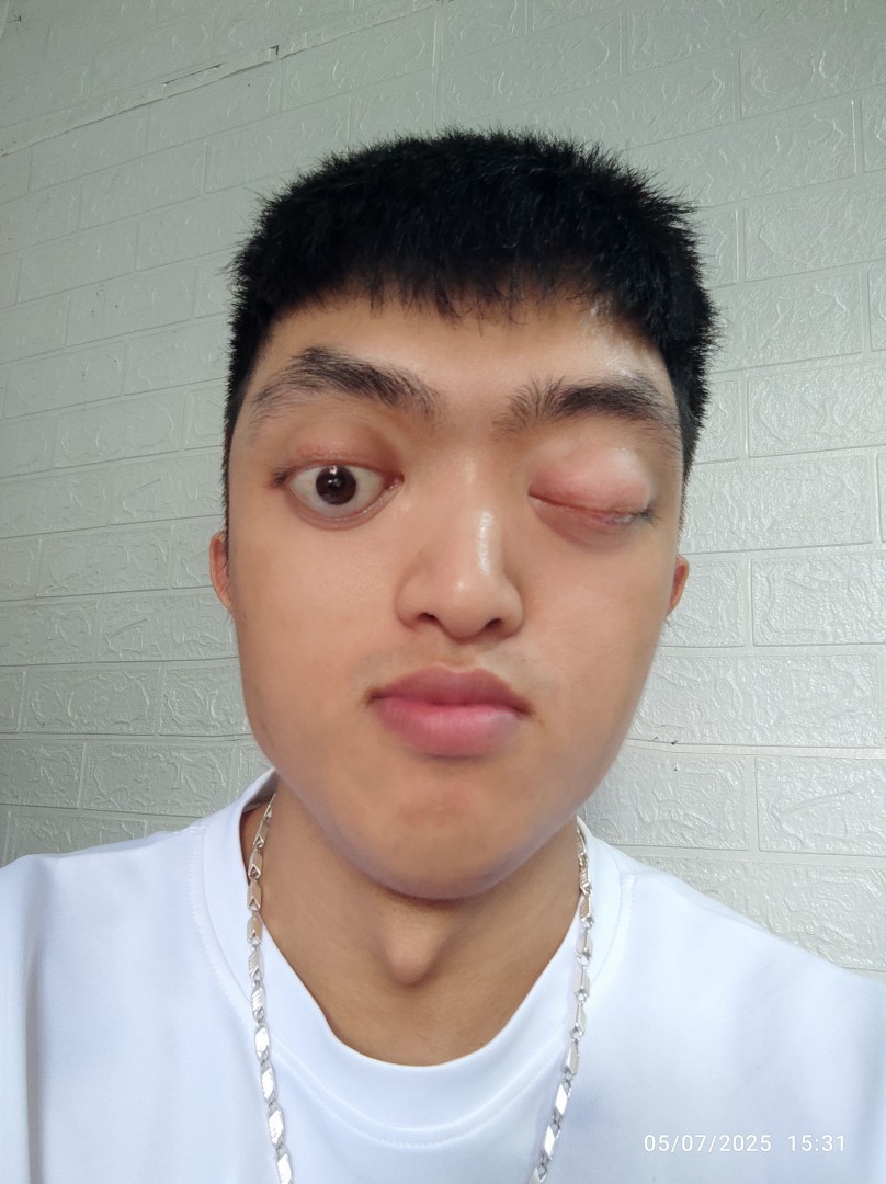 Ảnh lớn
