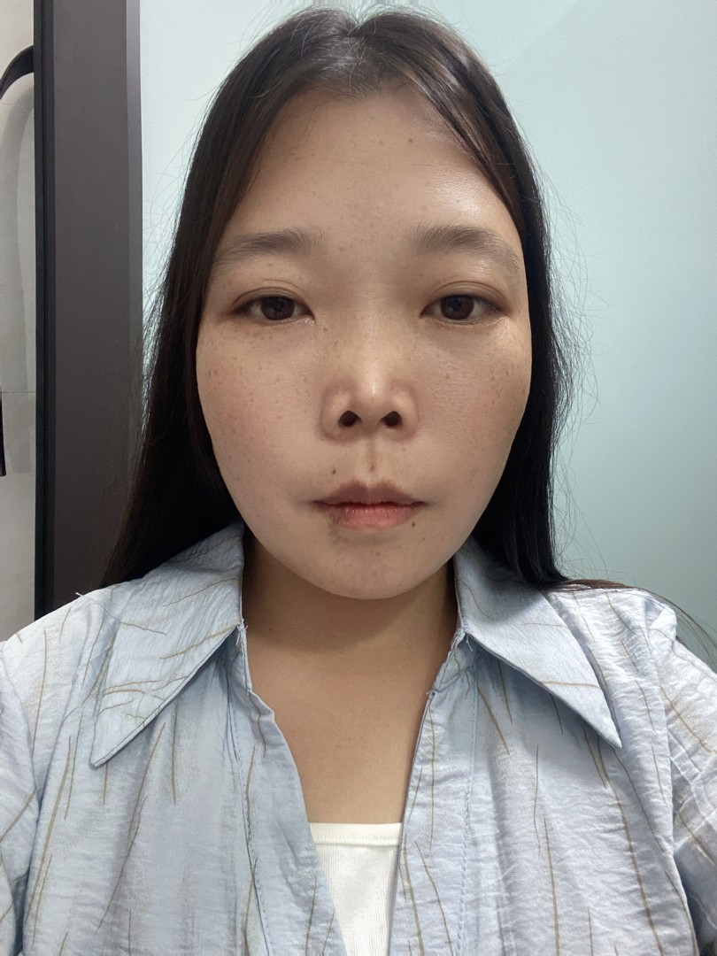 Ảnh lớn