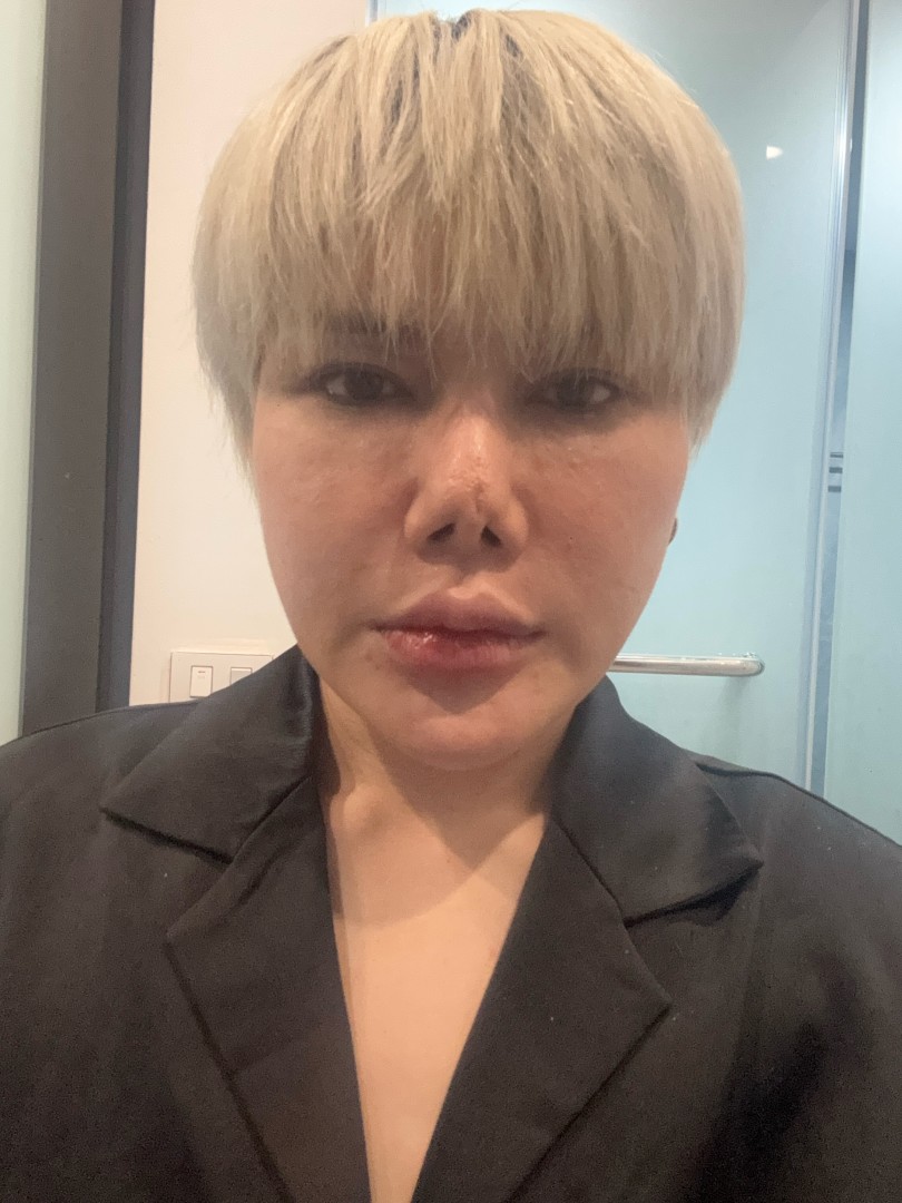 Ảnh lớn