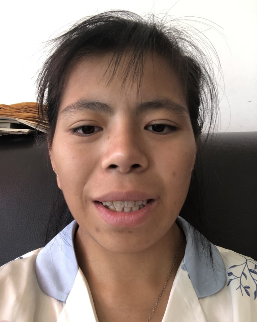 Ảnh lớn