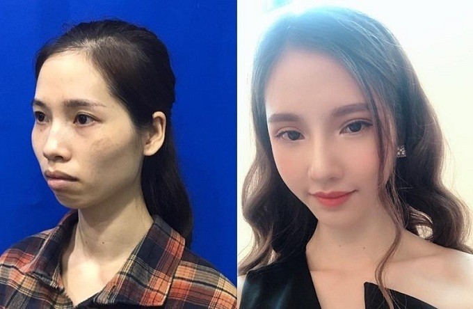 Phan Thị May trước và sau khi lột xác