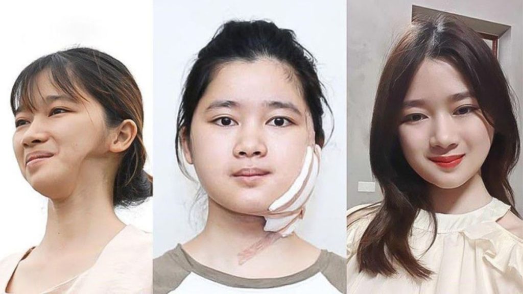 Chương trình Hành trình Lột xác có phẫu thuật thẩm mỹ 100%?